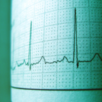 Upstate helps lead global trial that could change heart failure care