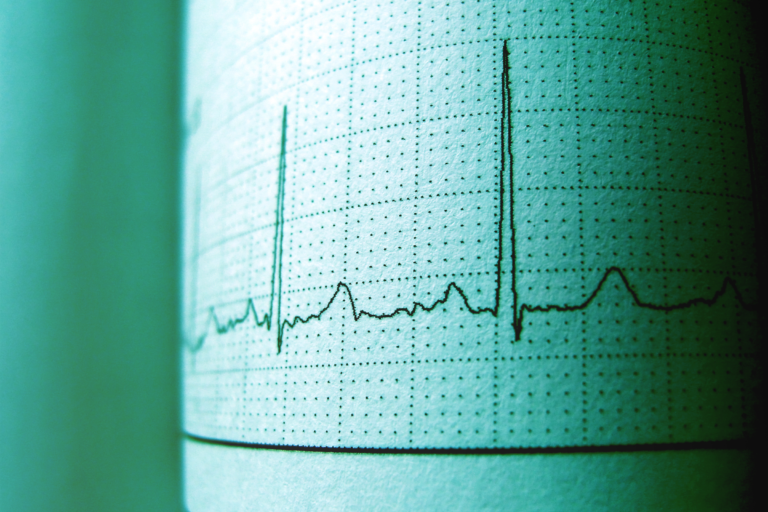 Upstate helps lead global trial that could change heart failure care